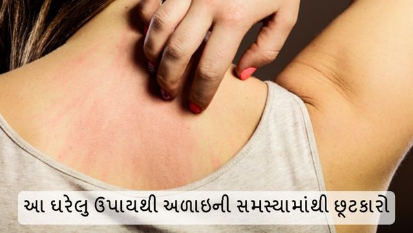 Summer Tips: ગરમીમાં થાય છે અળાઇની સમસ્યા, આ ઘરેલું ઉપાયથી મળશે રાહત