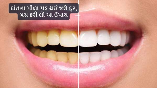 Oral Care Tips: દાંતના પીળા પડ થઈ જશે દૂર, બસ કરી લો આ ઉપાય