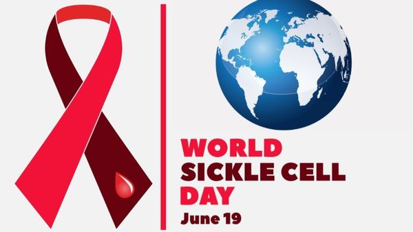 World Sickle Cell Day : સિકલ સેલ એનેમિયા નિયંત્રણ કાર્યક્રમ શરૂ કરનાર ગુજરાત દેશનું પ્રથમ રાજ્ય
