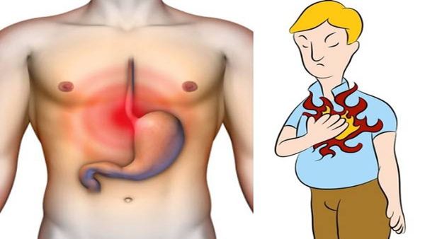 Health Tips: એસિડિટીથી મળશે ત્વરિત રાહત, ખાઇ લો આ વસ્તુ