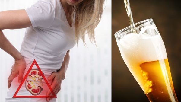 Kidney Stone : પથરી મટાડવા બિયર પી રહ્યાં છો તો સાવધાન..! જાણો શું કહે છે હેલ્થ એક્સપર્ટ?