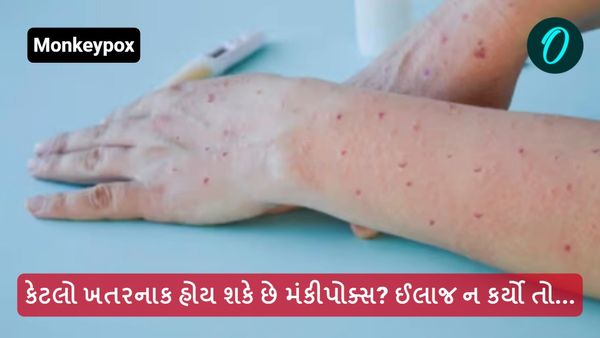 Post Monkeypox Risks: કેટલો ખતરનાક હોય શકે છે મંકીપોક્સ? ઈલાજ ન કર્યો તો...
