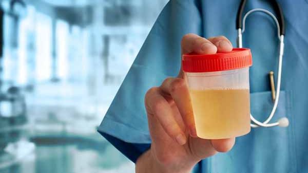 Urine based diseases : ઓછો પેશાબ આવે તો તાત્કાલિક સાવધાન થઈ જાઓ, હોઈ શકે છે આ ગંભીર બિમારી