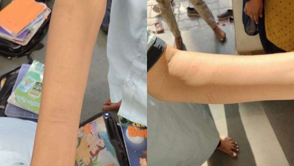 રમતમાં રાક્ષસી ખેલ: અમરેલીમાં 25 બાળકોએ બ્લેડ વડે હાથ પર કર્યા ઘા, વાલીઓ સ્તબ્ધ!