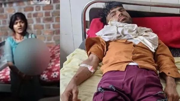 ઝઘડાની વચ્ચે પત્નીને આવ્યો એટલો ભયંકર ગુસ્સો કે પતિની જીભ જ કાપી નાંખી, દોઢ મહિના પહેલા જ થયા હતા લગ્ન