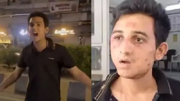 વડોદરા: અકસ્માત સર્જીને રક્ષિત ચૌરસિયા અન્ધર રાઉન્ડ...અન્ધર રાઉન્ડની કેમ પાડી રહ્યો હતો બૂમો? ખુલ્યુ રહસ્ય