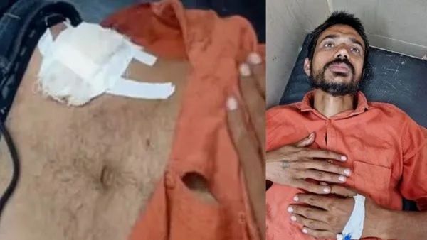 પેટમાં દુખાવો થયો તો YouTub વીડિયો જોઈને યુવક કરવા લાગ્યો પોતાનું ઓપરેશન, થઈ ગઈ હાલત ખરાબ