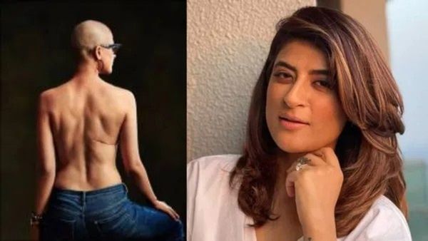 તાહિરા કશ્યપને બીજી વખત કેન્સર: આયુષ્માન ખુરાનાની પત્નીએ શેર કરી ભાવુક પોસ્ટ!