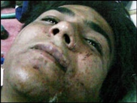 कसाब की हिरासत फिर बढ़ाई गई