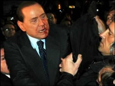 लहूलुहान बर्लुस्कोनी अस्पताल में