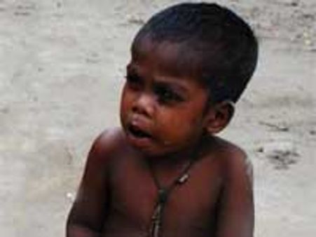 भानुमति के पिटारे से फिर निकला कुपोषण का जिन्न