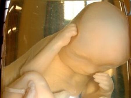 अलीगढ़ में मिले 11 अर्द्धविकसित भ्रूण