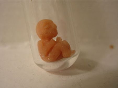 अब तक 50 लाख टेस्ट ट्यूब बेबी ले चुके जन्‍म