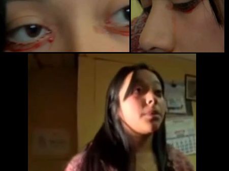 वीडियो में देखें कैसे खून के आंसू रोती है यह लड़की