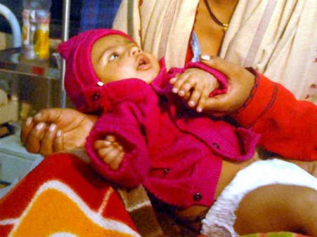 तीन महीने के मासूम ने मौत को मात दी