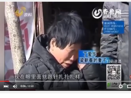 देखें वीडियो: इस महिला की आंखों से निकलते हैं छोटे-छोटे पत्थर