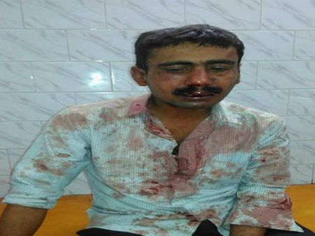 'सुशासन' में द टेलीग्राफ के पत्रकार को बदमाशों ने बुरी तरह पीटा