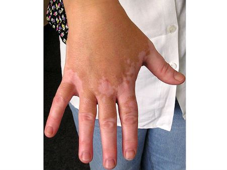 पुणे : बुजुर्ग महिला की बीमारी की वजह से ऐसी बेइज्जती कि आप भी हो जाएं शर्मसार