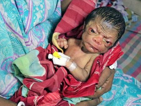 OMG! 80 साल के बूढ़े ने लिया जन्म, देखते रह गए लोग