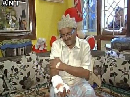ईमानदारी की मिली सज़ा, ठेकेदारों ने कुल्हाड़ी से काट दिया अधिकारी का हाथ