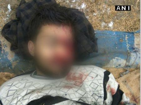 लखवी का भतीजा है बांदीपोर में मारा गया लश्‍कर आतंकी अबू मूसा!