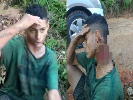 कटी हुई गर्दन के साथ पुलिस के पास पहुंचा लड़का, वीडियो वायरल