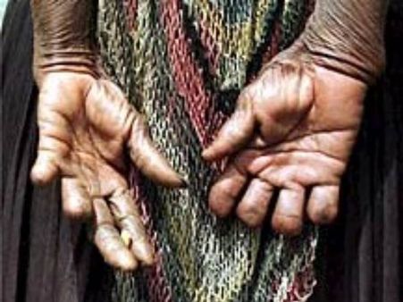 अजीब परंपरा: यहां घर के किसी सदस्य की मौत पर काट देते हैं महिलाओं की उंगलियां