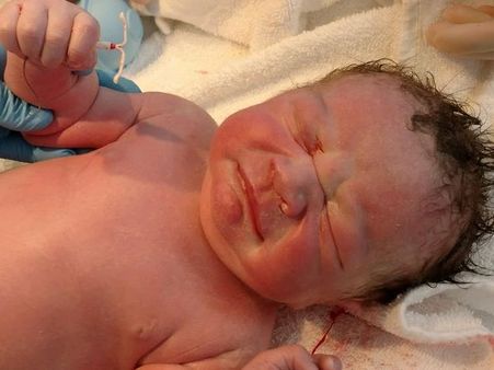 मां की गर्भनिरोधक डिवाईस के साथ पैदा हुआ बच्चा, तस्वीर हुई वायरल