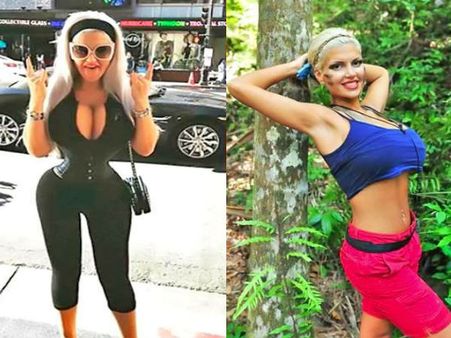 हॉट फिगर पाने के लिए शरीर से पस‍लियां तक निकलवा डालीं, देखें Pics