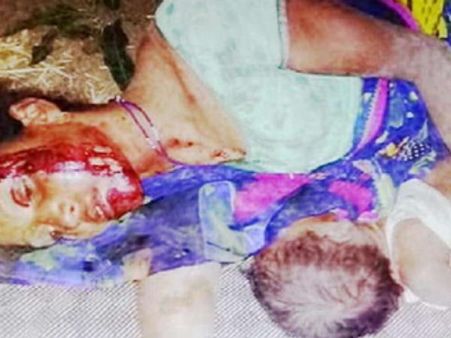 खुद लहूलुहान होकर भी बच्ची को स्तनपान कराती रही मां, तस्वीर वायरल