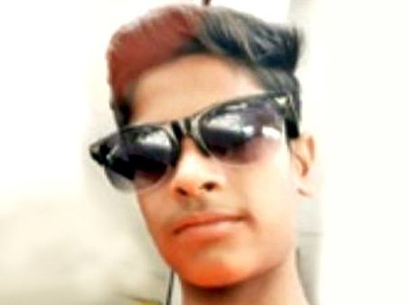 पैर में मोच बनी नाबालिग बच्चे की मौत की वजह, हैरान लोगों ने पूछा ये सवाल