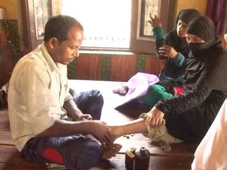 VIDEO: झोलाछाप- लकड़ी लगाकर जोड़ता है हड्डी, सीधी जुड़ी तो आपकी किस्मत अच्छी