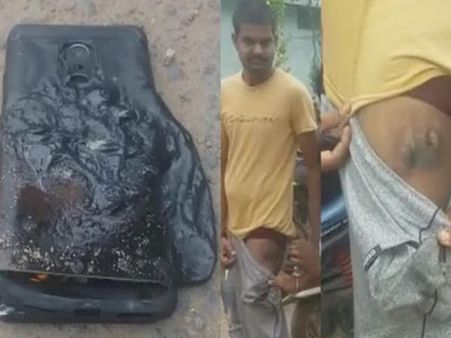 जेब में ही फट गया रेडमी नोट 4, पानी से भी नहीं बुझी आग!