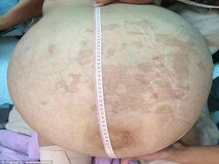 OMG: पिछले 7 साल से 'प्रेग्नेंट' थी ये महिला, जानिए कैसे