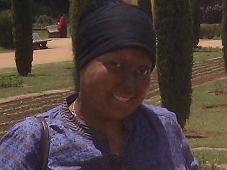 एसिड अटैक के बाद भी लोगों के लिए मिसाल बनीं प्रज्ञा