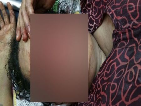 VIDEO: बहू-बेटे का प्यार नहीं होता था बर्दाश्त, बेटे ने फोड़ दी मां की आंखें