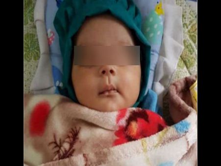 7 दांतों के साथ जन्मा दुनिया का पहला बच्चा, ऑपरेशन कर निकाला