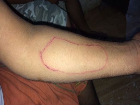 ब्लू ह्वेल गेम के मकड़जाल में फंसे तीन छात्र! काटी अपनी कलाई