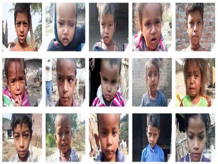 खसरा बना गांव का अभिशाप, 40 बच्चे बीमार लेकिन लापरवाह स्वास्थ्य विभाग