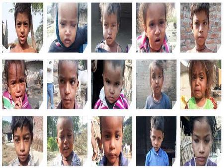 बहराइच में बच्चों की जान दांव पर, स्वास्थ्य विभाग को दवा बांटने का आदेश दीजिए योगी जी