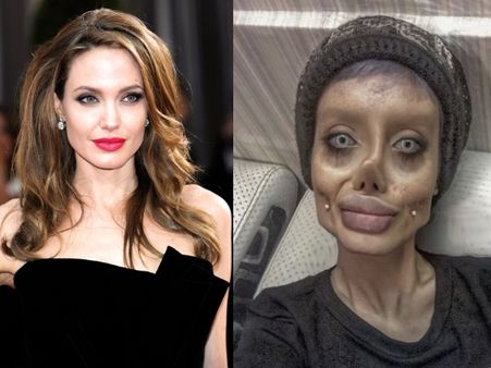 एंजलीना जॉली के जैसे दिखने के लिए इस लड़की ने करवाई 50 सर्जरी, लोगों ने नाम दिया 'Zombie'