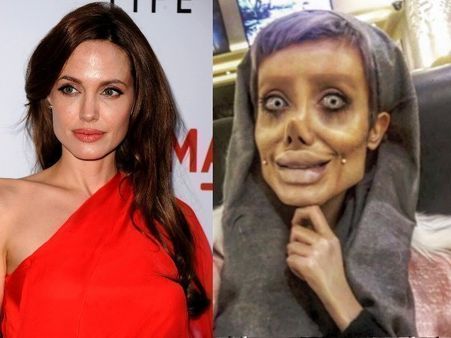 एंजलीना जॉली के जैसे दिखने वाली लड़की ने किया बड़ा खुलासा, बताया कैसे की शक्ल की ये हालत