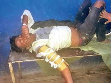 बिहार: हड्डी टूटने पर डॉक्टर ने प्लास्टर नहीं कार्टन बांधा, दर्द से कराहता रहा मरीज