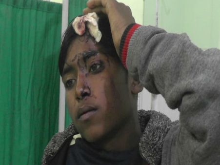 VIDEO: उसके प्रत्याशी को नहीं दिया वोट तो मतदाताओं को पीटकर किया घायल