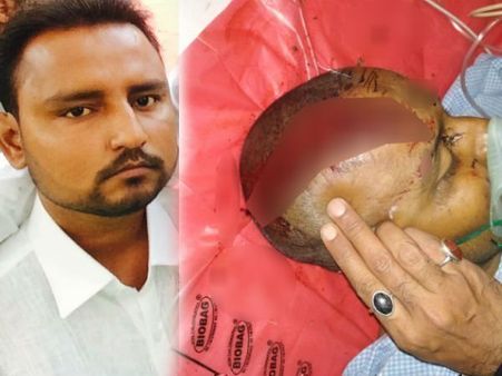 बस्‍ती- ग्राम प्रधान पर जानलेवा हमले को हादसे में तब्‍दील करती यूपी पुलिस
