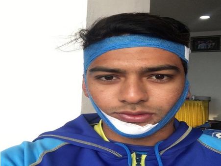 विजय हजारे ट्रॉफी: टूटे जबड़े के साथ खेलते हुए उन्मुक्त चंद ने जड़ा शतक, अनिल कुंबले की दिलाई याद