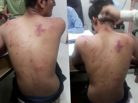 लखनऊ : इंटर के छात्र की बेरहमी से पिटाई, घाव बयां कर रहे हैं दरिंदगी की कहानी