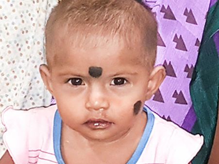 दिल की बीमारी से जूझ रही नन्ही कनिश्री, आपकी मदद दिला सकती है इसे राहत