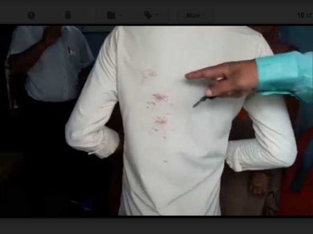 एक दिन स्कूल ना आने पर टीचर बना जल्लाद, छात्र को बेल्ट से पीटकर कर दिया लहूलुहान