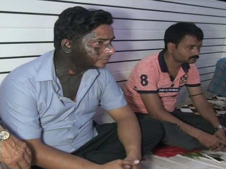 छेड़छाड़ का विरोध करने पर मनचलों ने मशहूर शायर हाशिम फिरोजाबादी से की मारपीट, चेहरे पर फेंका तेजाब